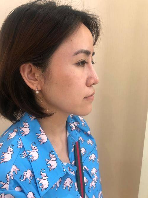 信阳美舒雅医疗美容门诊部地址电话营业时间