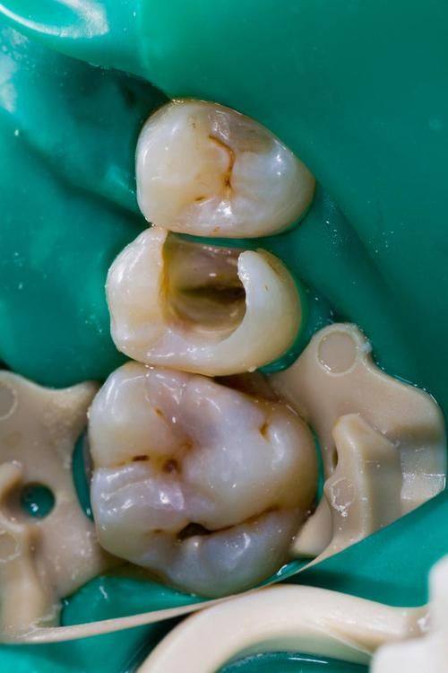 广西玉林恒兴口腔连锁地址电话营业时间