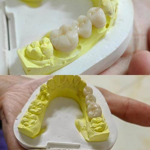 广西玉林恒兴口腔连锁详细的预约挂号方式及流程