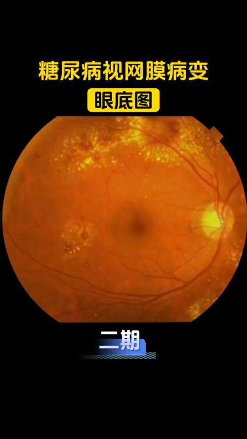 濉溪县医院眼科收费价格表/收费标准