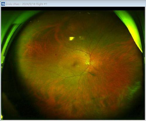 安徽中 医 药大学第一附属医院眼科真人口碑评价怎么样?