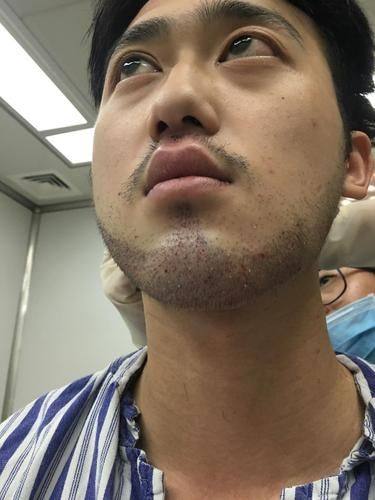 厦门雍禾植发医疗整形医院详细的预约挂号方式及流程