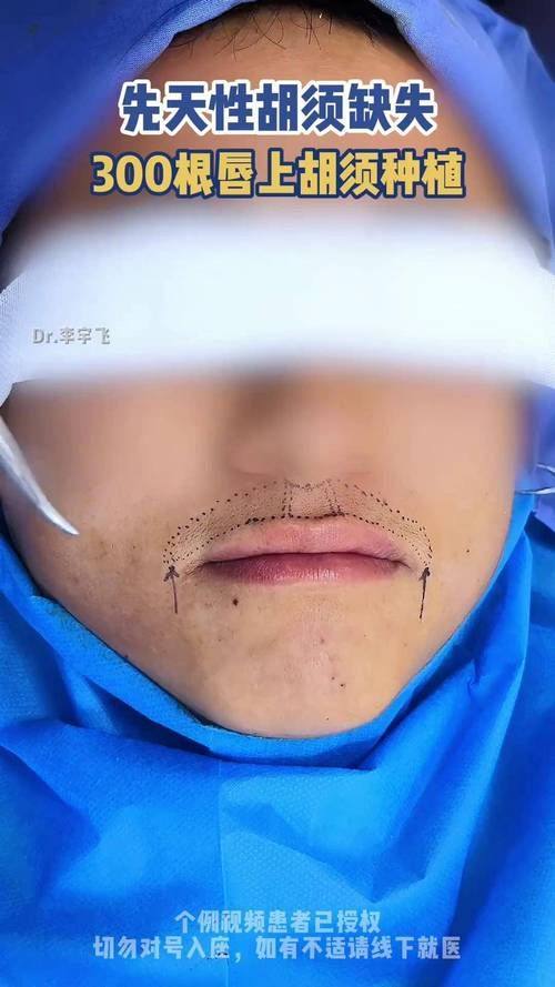 厦门雍禾植发医疗整形医院特色项目及技术优势