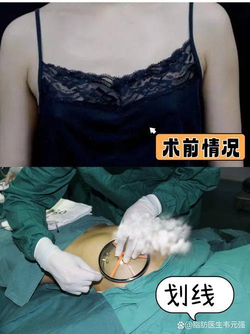 重庆精美整形医院是正规医院吗？