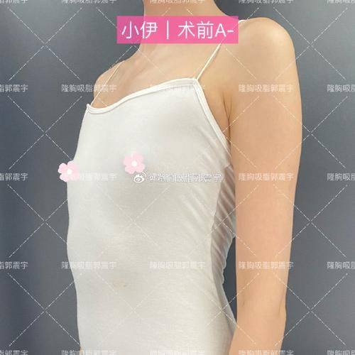 哈尔滨美尚线整形医疗美容门诊部地址电话营业时间