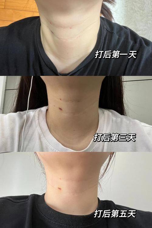 信阳美舒雅医疗美容门诊部特色项目及技术优势