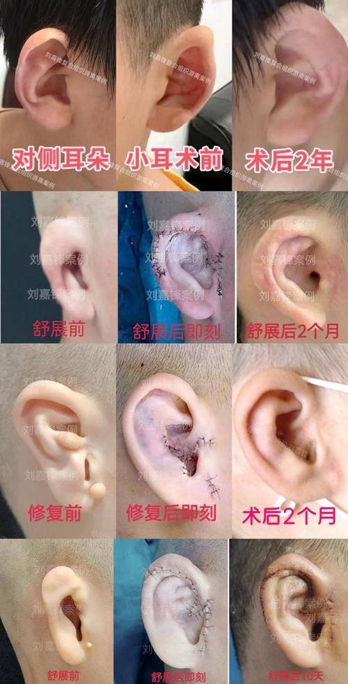 信阳美舒雅医疗美容门诊部真人口碑评价怎么样？