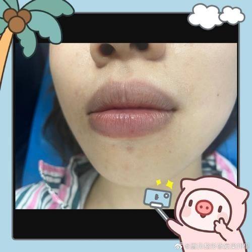 哈尔滨美尚线整形医疗美容门诊部医生团队实力强大及骨干医生简介