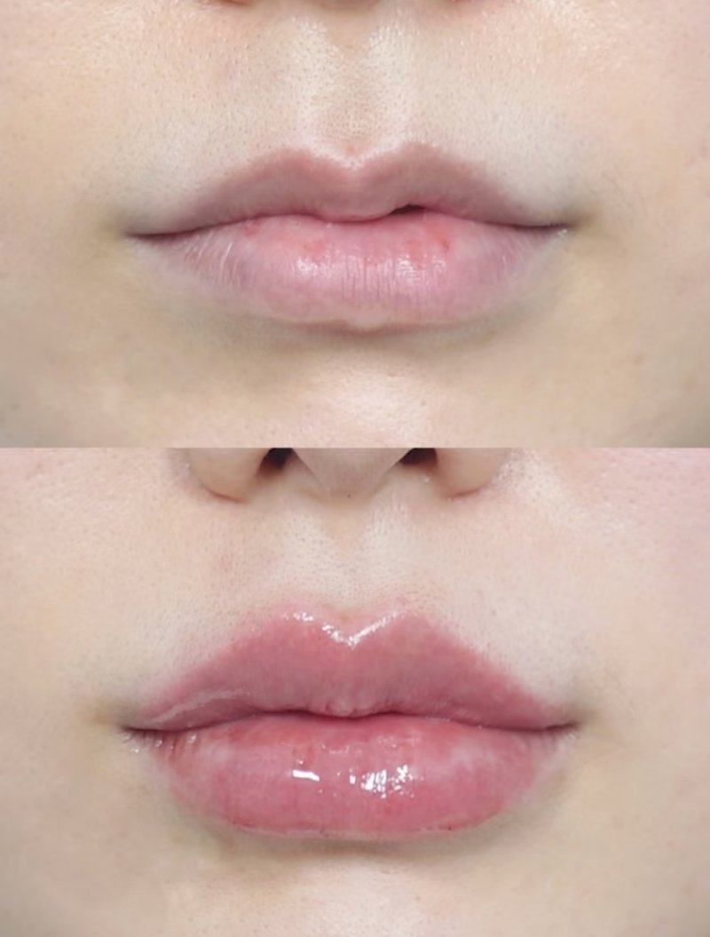 重庆精美整形医院特色项目及技术优势