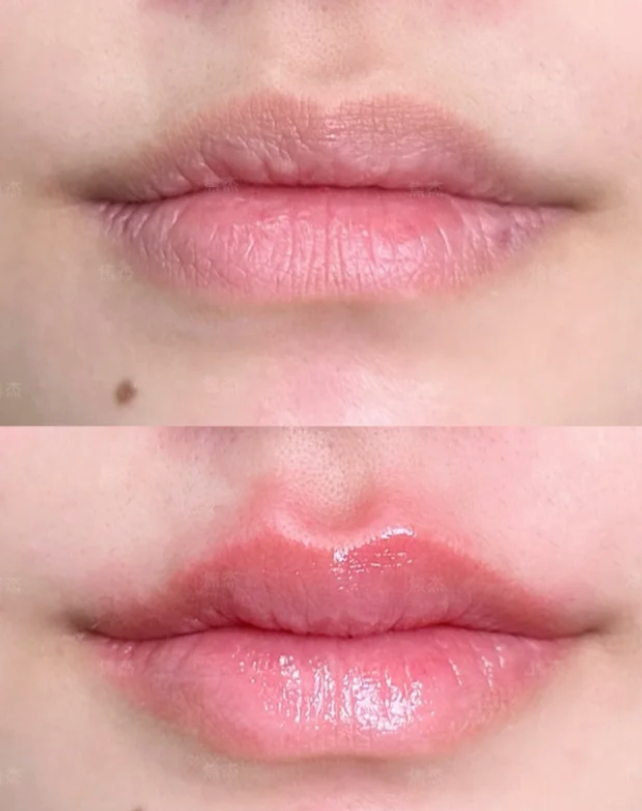 哈尔滨美尚线整形医疗美容门诊部特色项目及技术优势