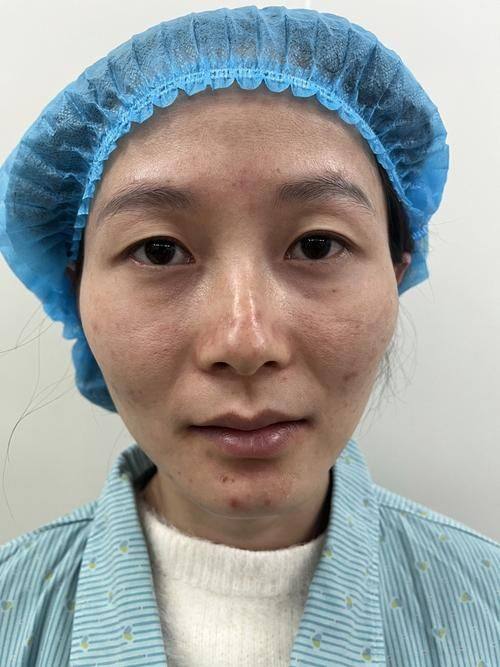 济南芭莎美恩整形医疗美容门诊部收费价格表/收费标准