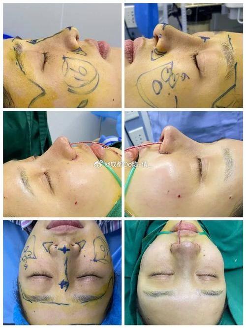 济南芭莎美恩整形医疗美容门诊部是正规医院吗？