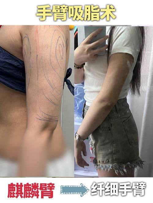 韩国哈娜儿整形外科地址电话营业时间