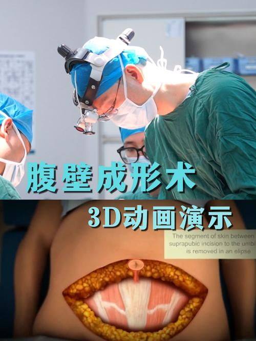 韩国哈娜儿整形外科是正规医院吗？