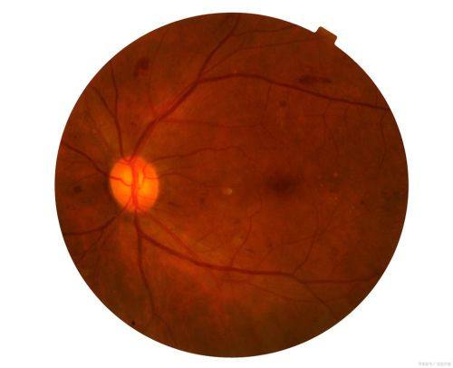 石家庄市中医院眼科真人口碑评价怎么样？