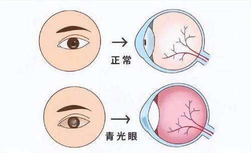 石家庄市中医院眼科是正规医院吗？