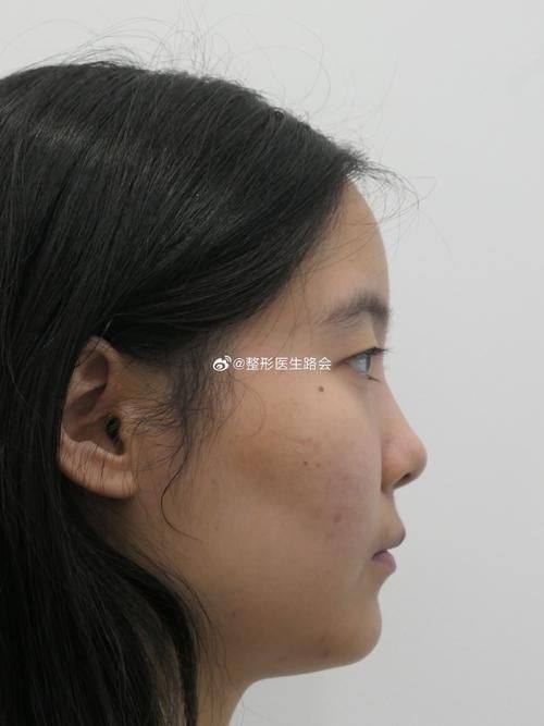 山西大同豪银美业整形医院是正规医院吗？