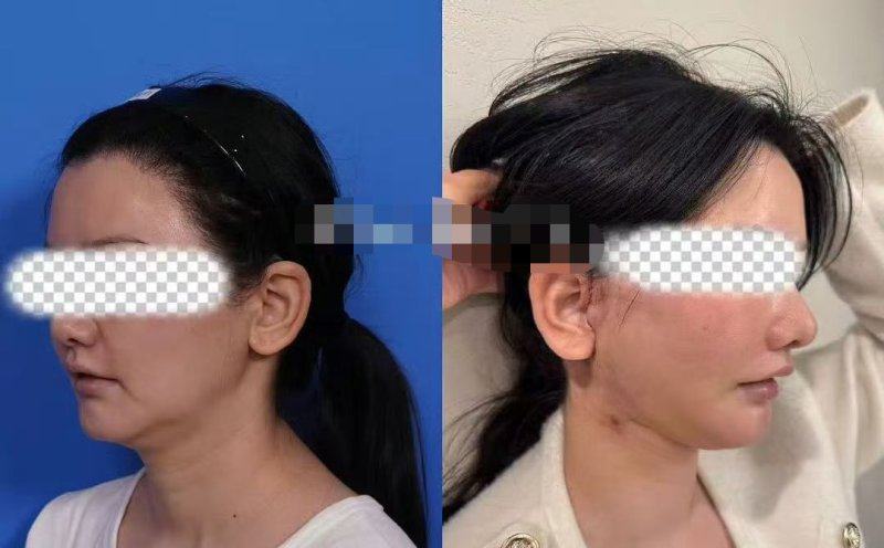 济南芭莎美恩整形医疗美容门诊部特色项目及技术优势