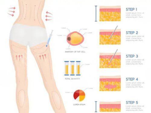 浙江杭州市第一人民医院是正规医院吗？