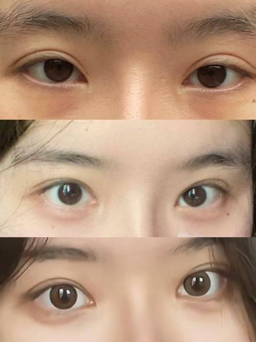 韩国GK整形医院特色项目及技术优势