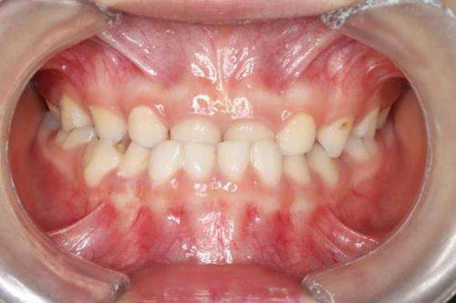 固德口腔门诊部(菱角湖店)详细的预约挂号方式及流程