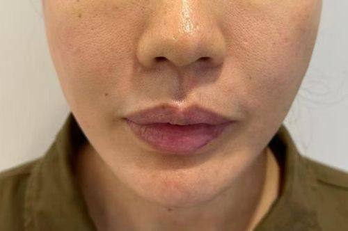 成都市妇女儿童中 心医院医疗美容科真人口碑评价怎么样?