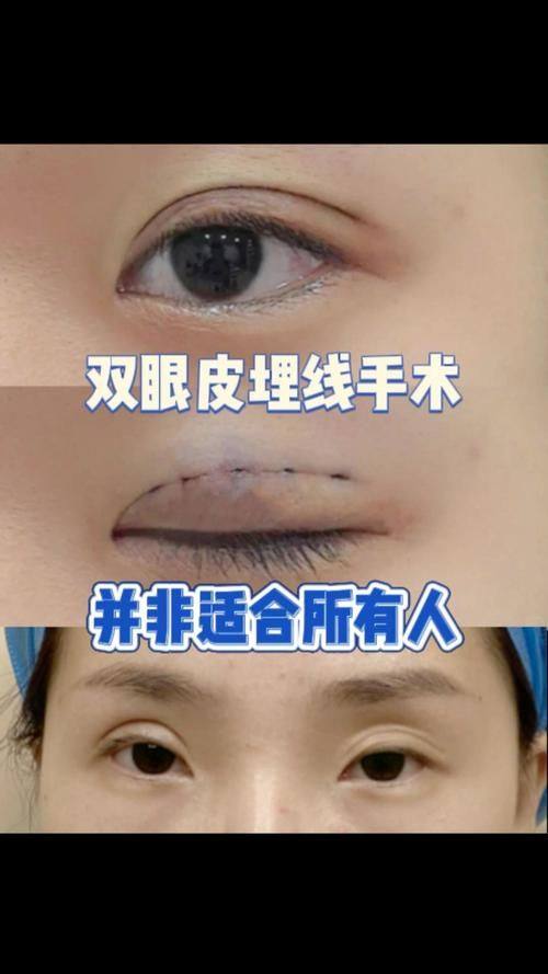 韩国GK整形医院是正规医院吗？