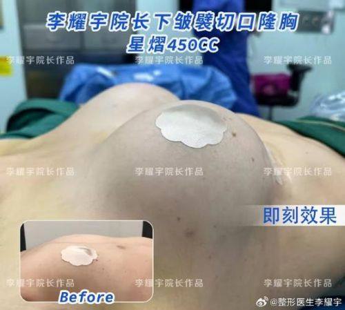 韩国GK整形医院收费价格表/收费标准