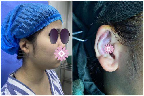 成都市妇女儿童中 心医院医疗美容科特色项目及技术优势