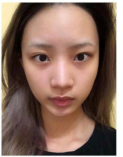 韩国GK整形医院真人口碑评价怎么样？