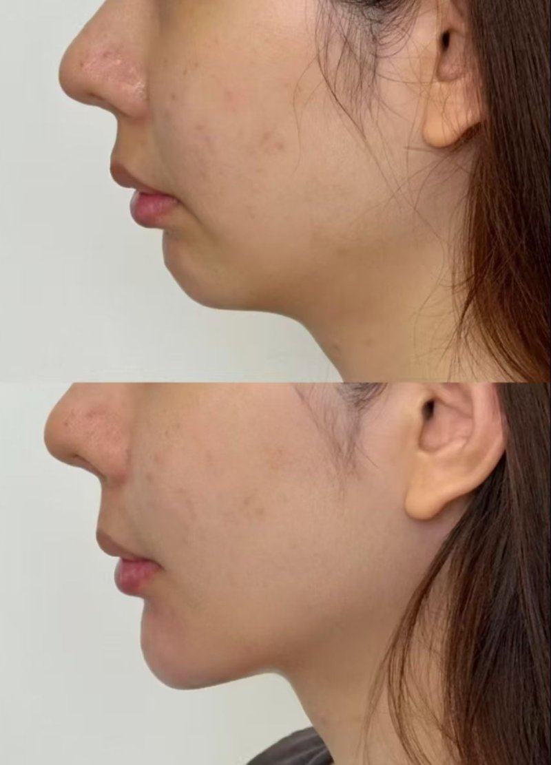 成都市妇女儿童中 心医院医疗美容科详细的预约挂号方式及流程