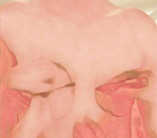 深圳富华整形医院详细的预约挂号方式及流程