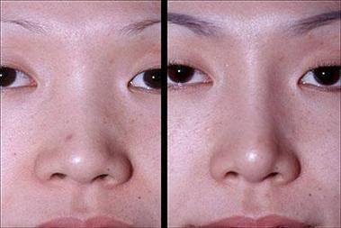 深圳富华整形医院是正规医院吗？