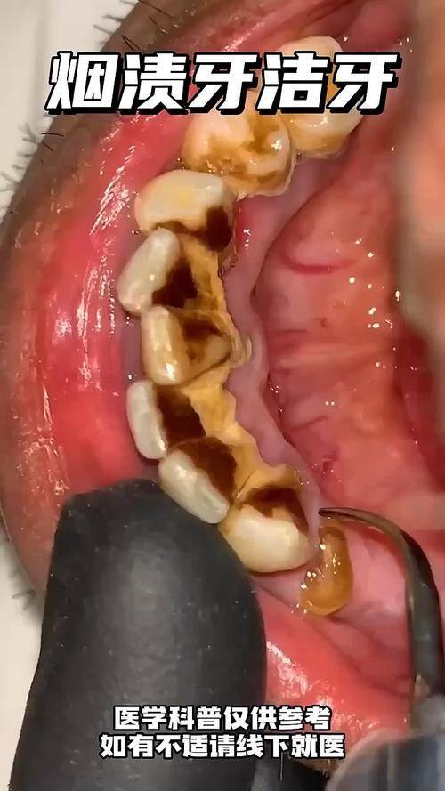 浙江宁波海曙刘锦亚口腔是正规医院吗？