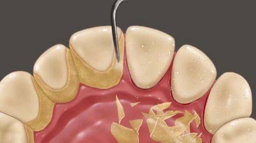 朝阳区欣雅口腔门诊部收费价格表/收费标准