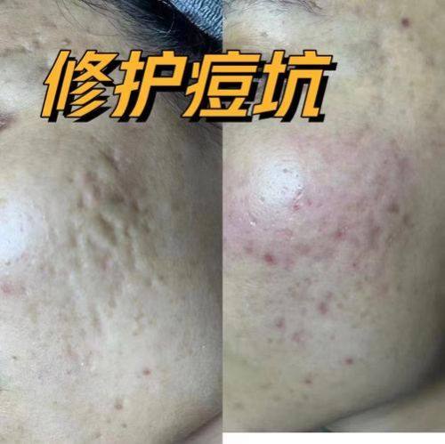 十堰市中医院美容科地址电话营业时间