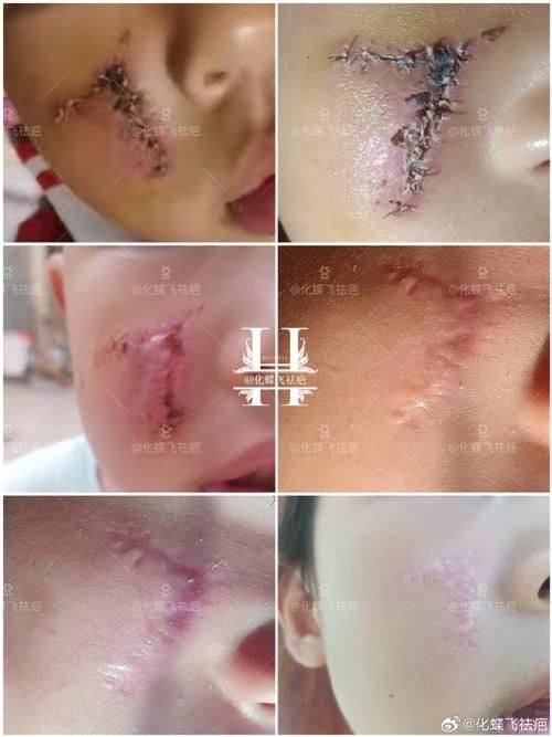 十堰市中医院美容科是正规医院吗?