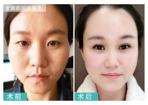 惠州元辰医疗美容医院特色项目及技术优势