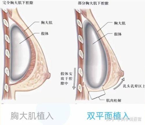 惠州元辰医疗美容医院真人口碑评价怎么样？