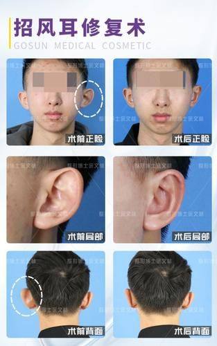 惠州元辰医疗美容医院收费价格表/收费标准