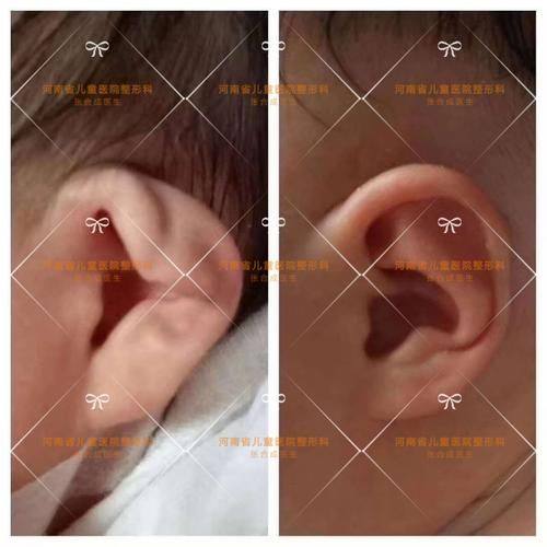 惠州元辰医疗美容医院是正规医院吗？