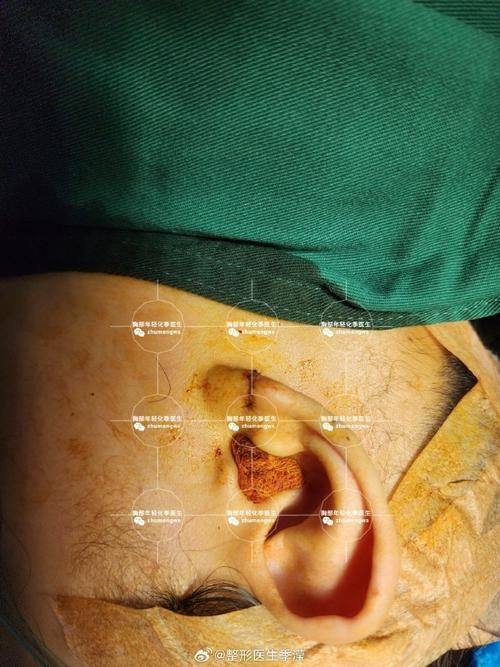 恩施奥莱整形医院特色项目及技术优势