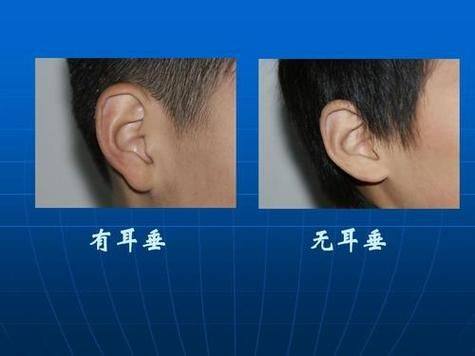 恩施奥莱整形医院详细的预约挂号方式及流程