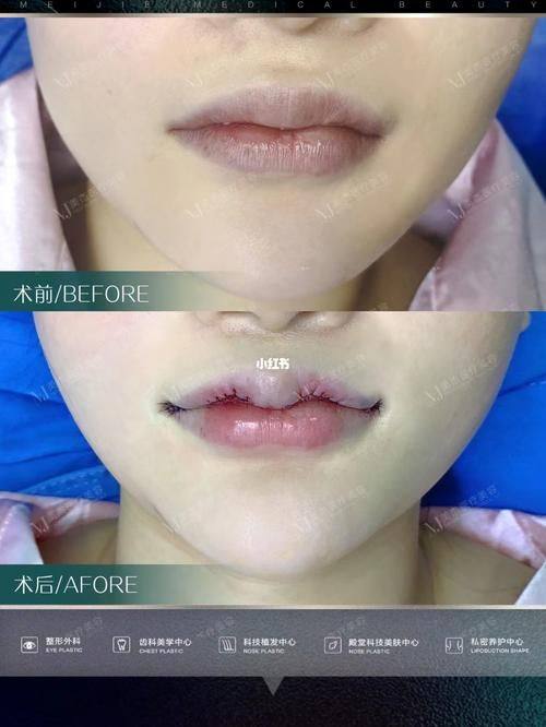 恩施奥莱整形医院是正规医院吗？