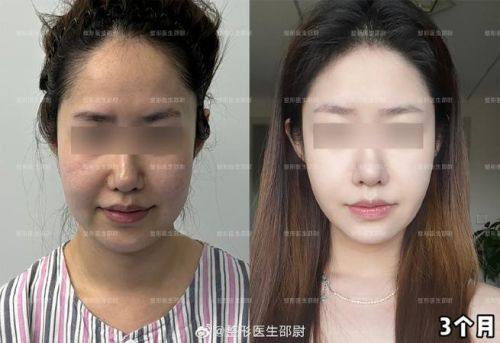 惠州元辰医疗美容医院详细的预约挂号方式及流程