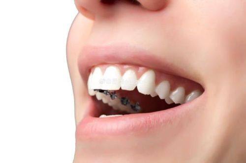 浙江大学医学校附属口腔医院口腔正畸学科真人口碑评价怎么样？