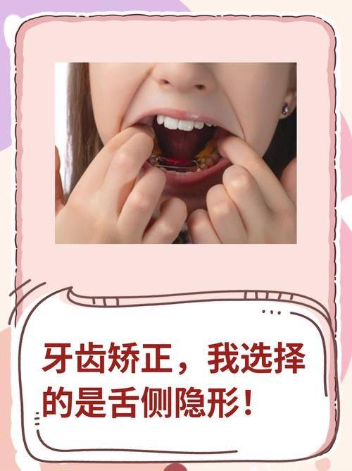 浙江大学医学校附属口腔医院口腔正畸学科详细的预约挂号方式及流程