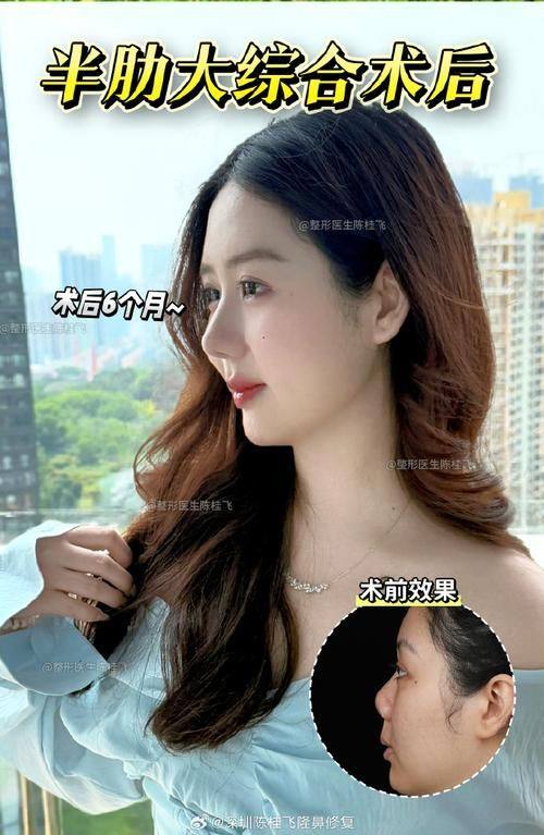 海南整形美容医院详细的预约挂号方式及流程