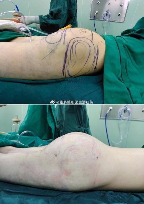 济南原纯医疗美容真人口碑评价怎么样？