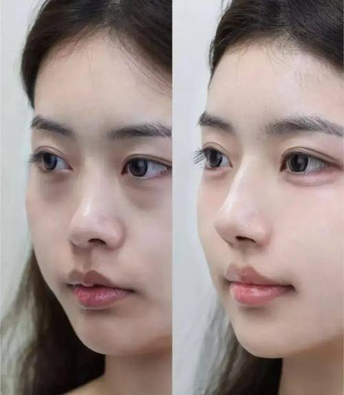 宜昌卓雅整形医院是正规医院吗？